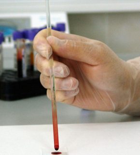Drug screenings